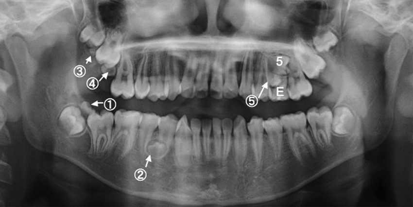 panoramique dentaire